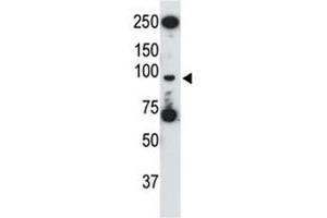 TLR5 antibody used in western blot to detect TLR5 in HL-60 cell lysate (TLR5 Antikörper  (AA 825-856))