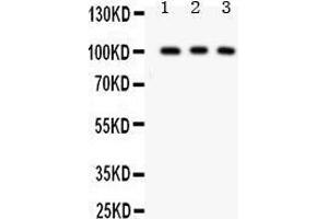 Anti- CD146 antibody, Western blotting All lanes: Anti CD146  at 0. (MCAM Antikörper  (AA 59-401))