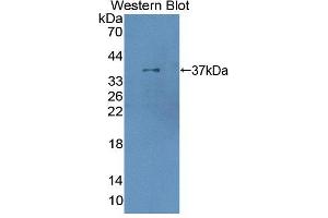 Figure. (XRN1 Antikörper  (AA 1394-1706))