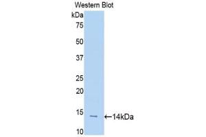 Western blot analysis of the recombinant protein. (SLIT1 Antikörper  (AA 3-112))