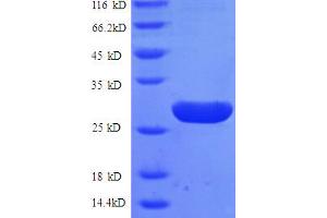 SDS-PAGE (SDS) image for G Protein-Coupled Receptor 161 (GPR161) (AA 1-28), (Extracellular), (partial) protein (GST tag) (ABIN5712333) (GPR161 Protein (AA 1-28, Extracellular, partial) (GST tag))