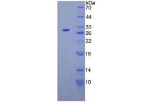 SDS-PAGE of Protein Standard from the Kit (Highly purified E. (ANGPTL2 ELISA Kit)
