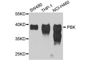 Western blot analysis of extract of various cells, using SPK antibody. (Symplekin Antikörper)