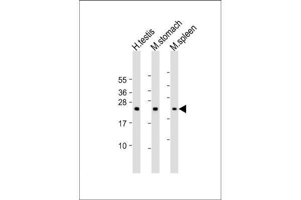 NAA40 Antikörper  (AA 179-222)