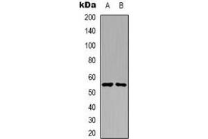 Western blot analysis of PKE expression in A431 (A), Raji (B) whole cell lysates. (STK32C Antikörper)