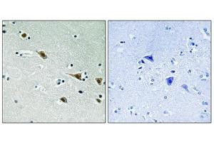 Immunohistochemical analysis of paraffin-embedded humanbrain tissue, using MAP2K7 (Phospho-Ser271) antibody (left)or the same antibody preincubated with blocking peptide (right). (MAP2K7 Antikörper  (pSer271))