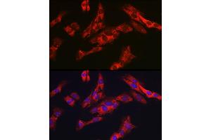 Immunofluorescence analysis of C6 cells using G6PC3 Rabbit pAb (ABIN7267401) at dilution of 1:200 (40x lens).