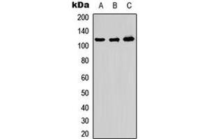 Western blot analysis of ADAMTS10 expression in HeLa (A), PC12 (B), Raw264. (ADAMTS10 Antikörper  (Center))