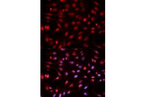 Immunofluorescence analysis of HeLa cells using APEX1 antibody. (APEX1 Antikörper  (AA 1-318))