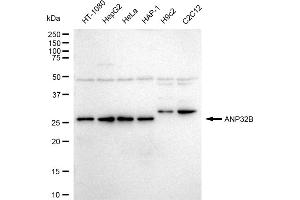 Western blotting analysis using ANP32B antibody (ABIN7797448).