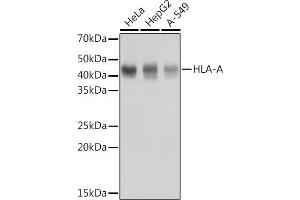 Western blot analysis of extracts of various cell lines, using HLA-A antibody (ABIN7268366) at 1:1000 dilution.