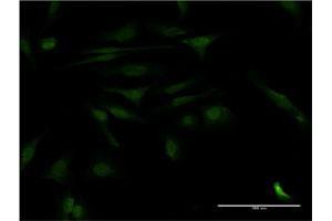 Immunofluorescence of monoclonal antibody to CALCOCO2 on HeLa cell. (CALCOCO2 Antikörper  (AA 347-446))