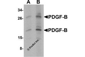 Western Blotting (WB) image for anti-Platelet Derived Growth Factor Subunit B (PDGFB) (C-Term) antibody (ABIN1077433) (PDGFB Antikörper  (C-Term))