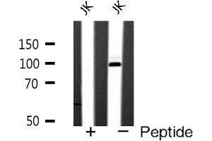 Western blot analysis of GluR4 expression in JK cells (Metabotropic Glutamate Receptor 4 Antikörper  (C-Term))