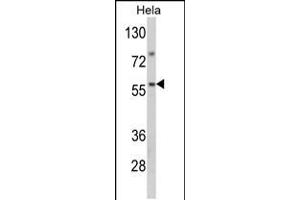 Western blot analysis of SARS2 Antibody in Hela cell line lysates (35ug/lane) (SARS2 Antikörper  (AA 315-344))