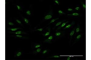 Immunofluorescence of purified MaxPab antibody to ZCCHC9 on HeLa cell. (ZCCHC9 Antikörper  (AA 1-271))