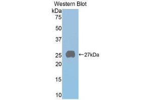 Western Blotting (WB) image for anti-Prolactin Receptor (PRLR) (AA 20-229) antibody (ABIN3203012) (Prolactin Receptor Antikörper  (AA 20-229))