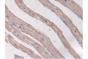 Figure. (Adiponectin Receptor 2 Antikörper  (AA 1-147))