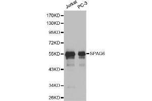 Western blot analysis of extracts of various cell lines, using SPAG6 antibody (ABIN6291215). (SPAG6 Antikörper)