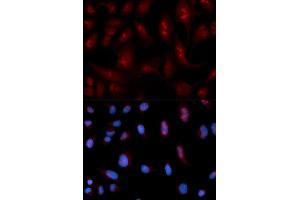 Immunofluorescence analysis of U2OS cell using PLCB1 antibody. (Phospholipase C beta 1 Antikörper)