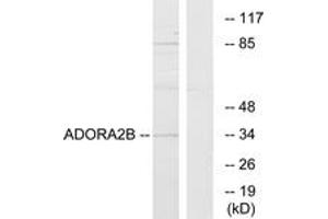 Western Blotting (WB) image for anti-Adenosine A2b Receptor (ADORA2B) (AA 231-280) antibody (ABIN2890803) (Adenosine A2b Receptor Antikörper  (AA 231-280))