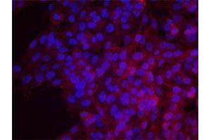 Immunofluorescence (IF) image for anti-Epidermal Growth Factor Receptor (EGFR) antibody (ABIN2664938) (EGFR Antikörper)