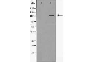 Western blot analysis of Integrin α5 (CD49e) expression in HeLa cells,The lane on the left is treated with the antigen-specific peptide. (ITGA5 Antikörper  (Internal Region))