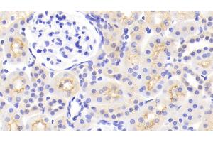 Immunohistochemistry (IHC) image for anti-Monoamine Oxidase A (MAOA) (AA 2-497) antibody (ABIN7440716)