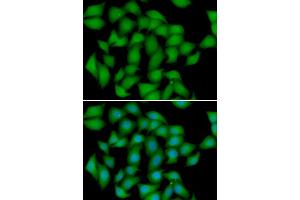 Immunofluorescence analysis of HeLa cell using ATOX1 antibody. (ATOX1 Antikörper)