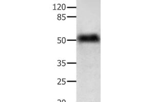 Western Blot analysis of Human lymphoma tissue using ACTG1 Polyclonal Antibody at dilution of 1:350