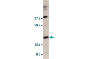 Western blot analysis of CRADD in HeLa total cell lysate with CRADD polyclonal antibody  at 1 ug/mL .