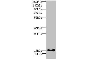 Western blot All lanes: ISCA2 antibody at 0. (ISCA2 Antikörper  (AA 9-154))