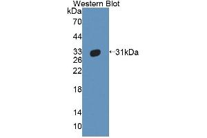 Detection of Recombinant ABCB11, Human using Polyclonal Antibody to ATP Binding Cassette Transporter B11 (ABCB11) (ABCB11 Antikörper  (AA 421-663))