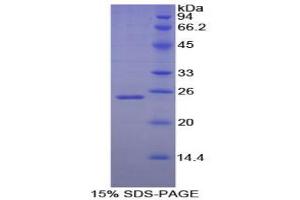 SDS-PAGE analysis of Dog Noggin Protein.