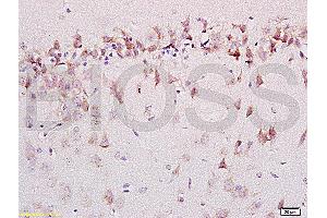 Formalin-fixed and paraffin embedded labeled with rat brain Anti-AMBRA1 Polyclonal Antibody, Unconjugated (ABIN704741) 1:200 followed by conjugation to the secondary antibody and DAB staining (AMBRA1 Antikörper  (AA 221-320))