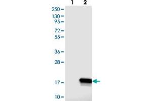 Western blot analysis of Lane 1: Negative control (vector only transfected HEK293T lysate), Lane 2: Over-expression Lysate (Co-expressed with a C-terminal myc-DDK tag (~3. (C14ORF119 Antikörper)