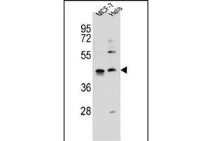 ZN Antibody (C-term) (ABIN655885 and ABIN2845286) western blot analysis in MCF-7,Hela cell line lysates (35 μg/lane). (ZNF384 Antikörper  (C-Term))