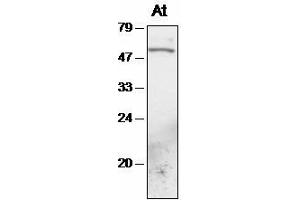 Western blot analysis of Arabidopsis chloroplast proteins with anti-TAK1 (Serine/threonine Protein Kinase (At4g02630) Antikörper)