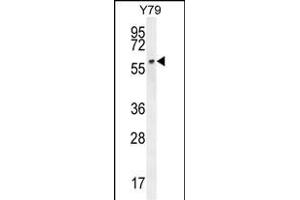 LCOR Antibody (C-term) (ABIN654358 and ABIN2844122) western blot analysis in Y79 cell line lysates (35 μg/lane).