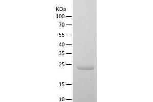 Reelin Protein (RELN) (AA 26-254) (His tag)