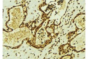 Immunohistochemistry (IHC) image for anti-Treacher Collins-Franceschetti Syndrome 1 (TCOF1) (N-Term) antibody (ABIN6257543)