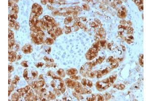 Formalin-fixed, paraffin-embedded human Pancreas stained with GP2 Mouse Monoclonal Antibody (GP2/1805). (GP2 Antikörper  (AA 35-179))