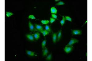 Immunofluorescence staining of Hela cells cells with ABIN7163449 at 1: 200, counter-stained with DAPI. (PIH1D1 Antikörper  (AA 1-290))