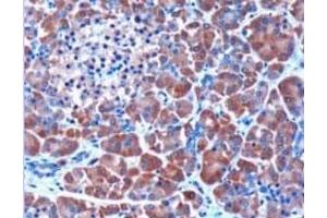Image no. 1 for anti-serpin Peptidase Inhibitor, Clade I (Pancpin), Member 2 (SERPINI2) (Internal Region) antibody (ABIN374538) (SERPINI2 Antikörper  (Internal Region))