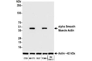 Western Blotting (WB) image for anti-Actin, alpha 2, Smooth Muscle, Aorta (ACTA2) (AA 1-50) antibody (ABIN7449438)
