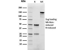 SDS-PAGE Analysis. (Rekombinanter Myoglobin Antikörper)