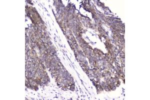 Immunohistochemistry (IHC) image for anti-Fatty Acid Binding Protein 3, Muscle and Heart (FABP3) (AA 2-133) antibody (ABIN6654044)