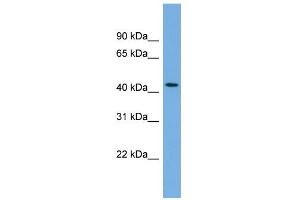 WB Suggested Anti-SKA3 Antibody Titration: 0. (SKA3 Antikörper  (Middle Region))