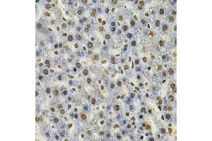 Immunohistochemistry of paraffin-embedded rat liver using IFI16 Antibody. (IFI16 Antikörper)