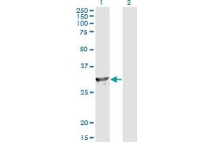 Western Blot analysis of SPR expression in transfected 293T cell line by SPR monoclonal antibody (M01), clone 4F2. (SPR Antikörper  (AA 164-260))